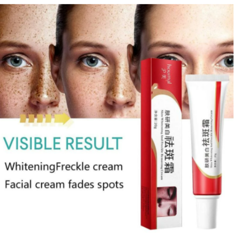 Buy 1 Take 1 999pesos- Niacinamide Freckle Cream - Fades Melasma/Freckle/Sunburn/Age Spots/Radiant Spot